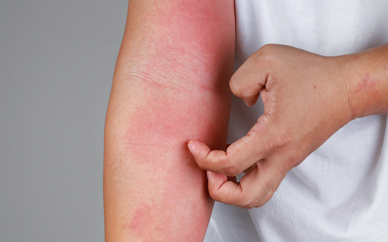 carpet cleaning in brooklyn, carpet cleaning in brooklyn, carpet cleaning brooklyn, carpet cleaners in brooklyn, carpet cleaners in brooklyn, commercial carpet cleaning, commercial carpet cleaning in brooklyn, brooklyn rug cleaners, rug cleaning services in brooklyn, same day carpet cleaning, same day rug cleaning